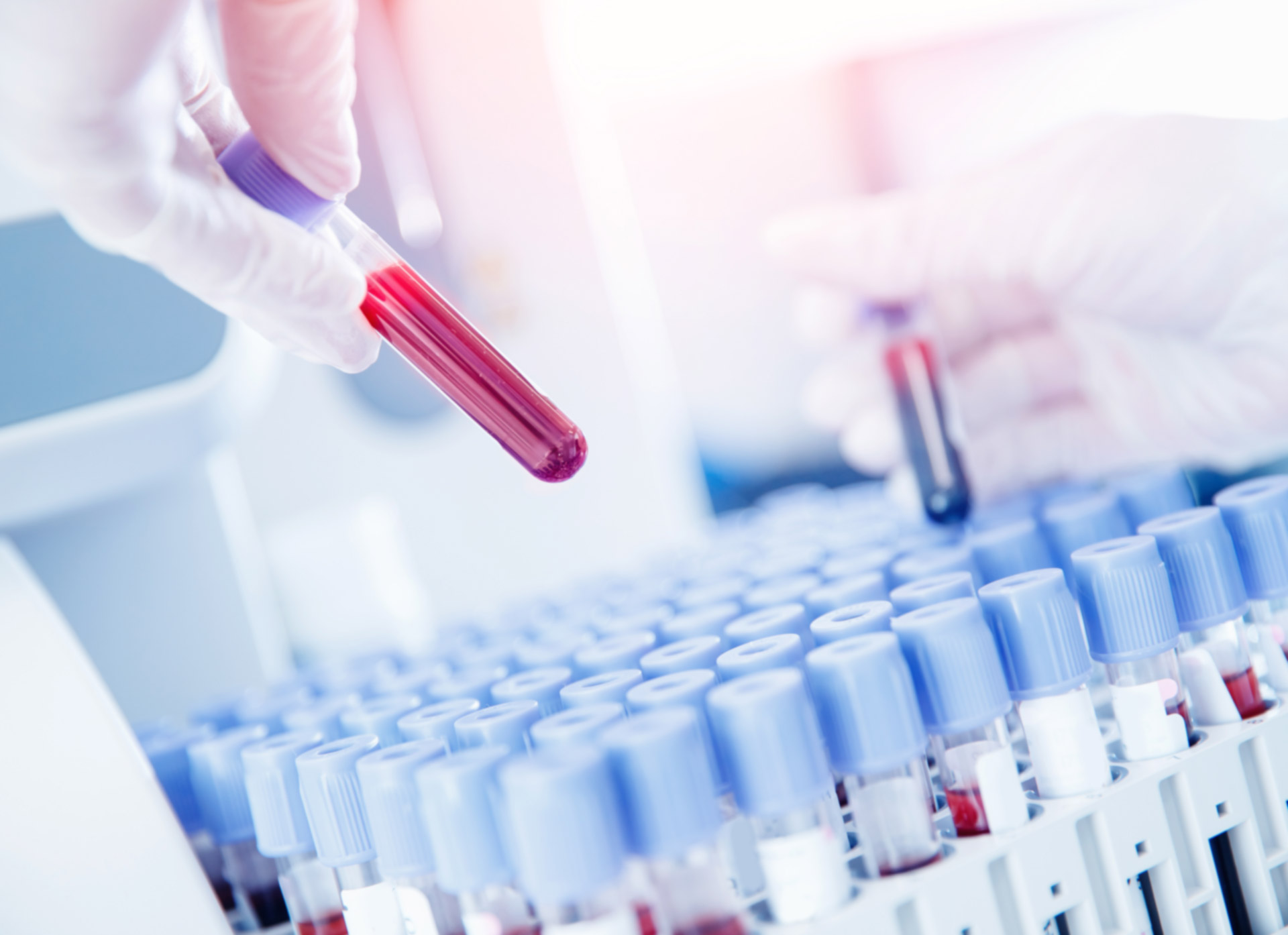 eNBiolab UG – Präzise Diagnostik für neurodegenerative Erkrankungen – Unsere Lösung